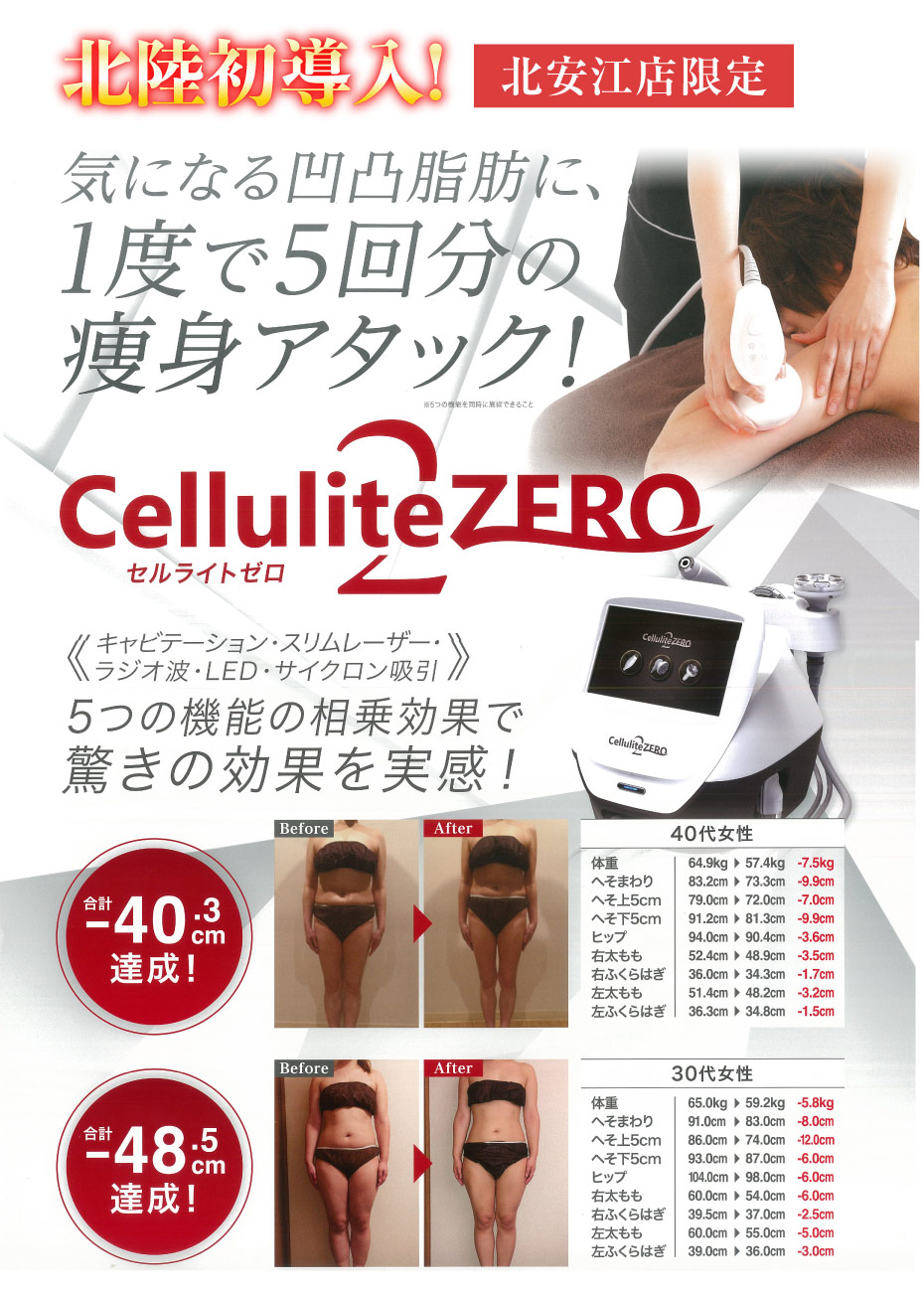 北陸初導入!北安江店限定
					気になる凸凹脂肪に１度で５回分の痩身アタック!セルライトゼロ2 ５つの機能の相乗効果で驚きの効果を実感!