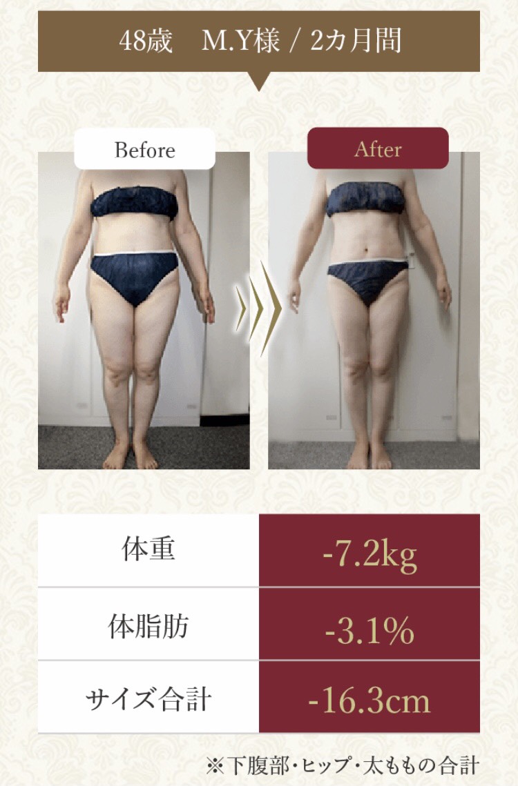 セルライトゼロ２ビフォーアフター